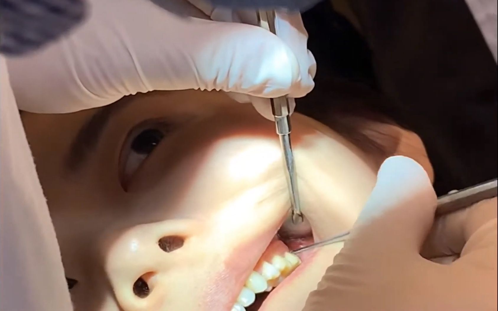 我的美女朋友拔智齿_哔哩哔哩_bilibili