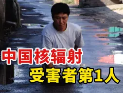 Télécharger la video: 1条手链吞噬半个身体！背后真相细思极恐