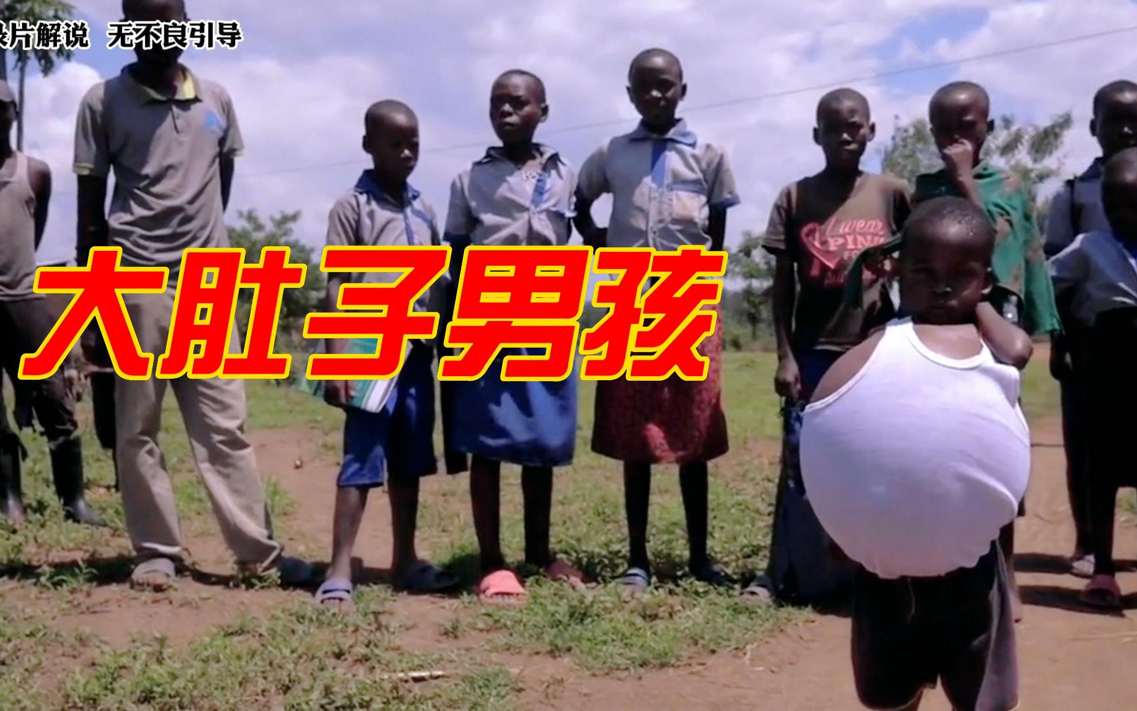 小男孩身患生病,肚子像皮球一样大,渴望与小伙一起玩耍