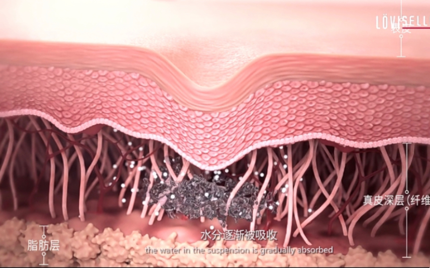 再生材料一定比玻尿酸香?少女针,童颜针,果冻针是啥原理哔哩哔哩bilibili