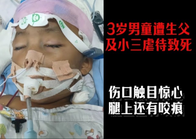 [图]3岁男童被生父女友长期虐待致死，两人却打卡秀恩爱，监控视频过于暴力，以至于警方也不忍给妈妈看