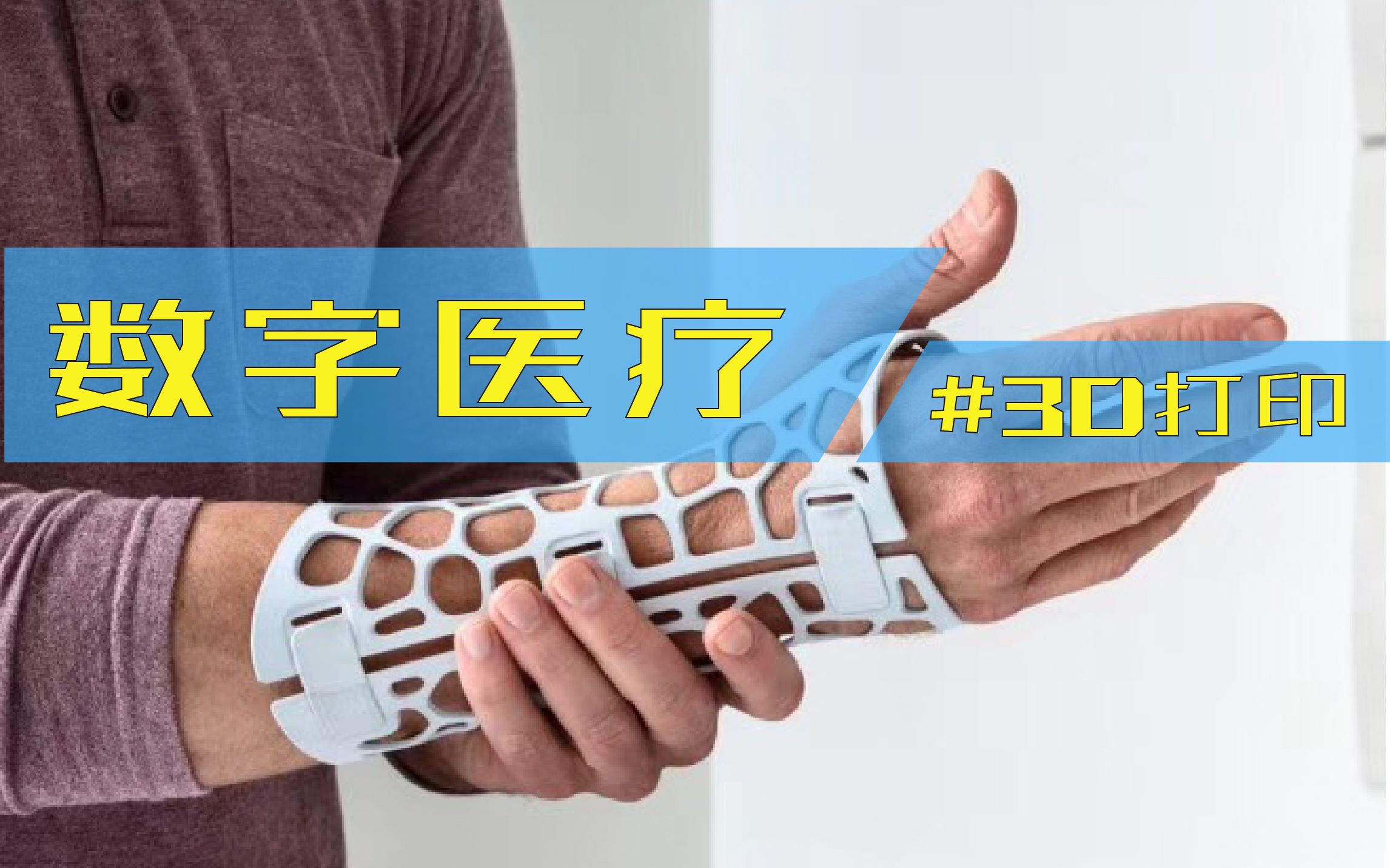 很多人不清楚3D打印在医疗领域的用法?中天云迪3D打印真实应用案例,展示3D打印在骨科、内脏病灶部位术前分析模型的应用.哔哩哔哩bilibili