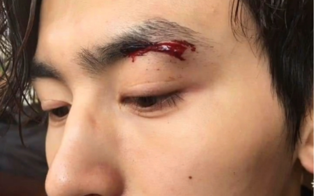 活动作品张哲瀚受伤05合集你能坚持看到最后吗