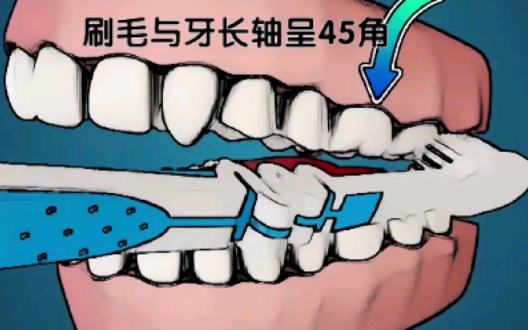 活動作品巴氏刷牙法幫你遠離蛀牙