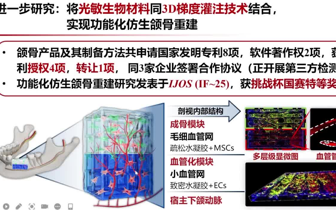 20220820浙江大学俞梦飞基于生物材料和干细胞的颅颌面组织缺损修复及再生的基础和临床研究哔哩哔哩bilibili