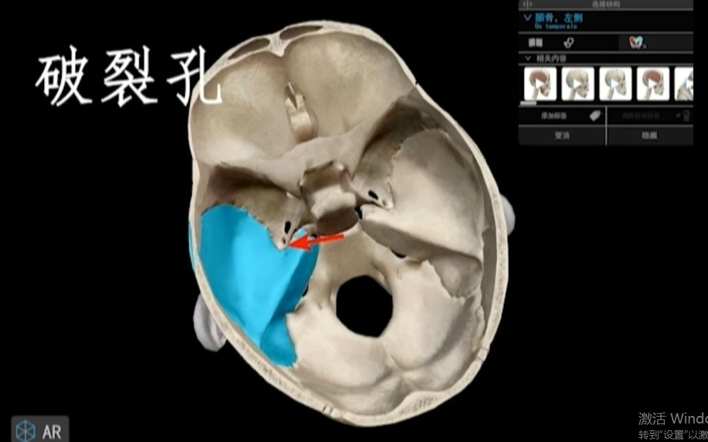 [图]【人解三分钟】人体骨骼之颅底：看懂颅底的孔洞，弄清自己的“脑洞”