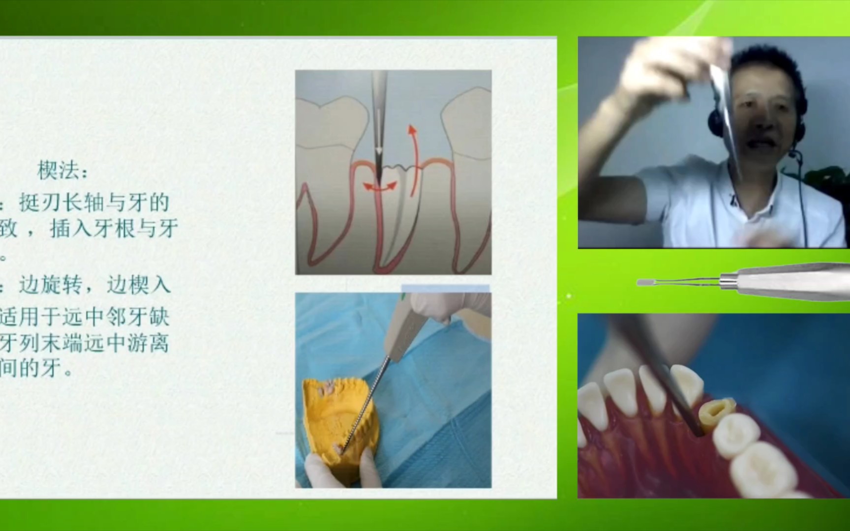 [图][拔牙] 牙挺使用技巧—挺法、推法、楔法、撬法