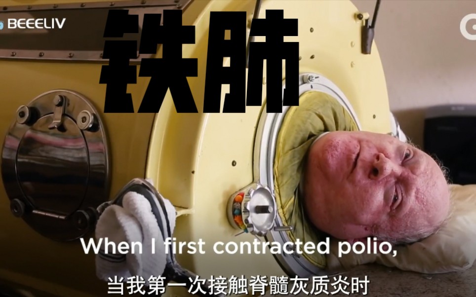 中英字最后一位铁肺人被小儿麻痹症耽误的一代人