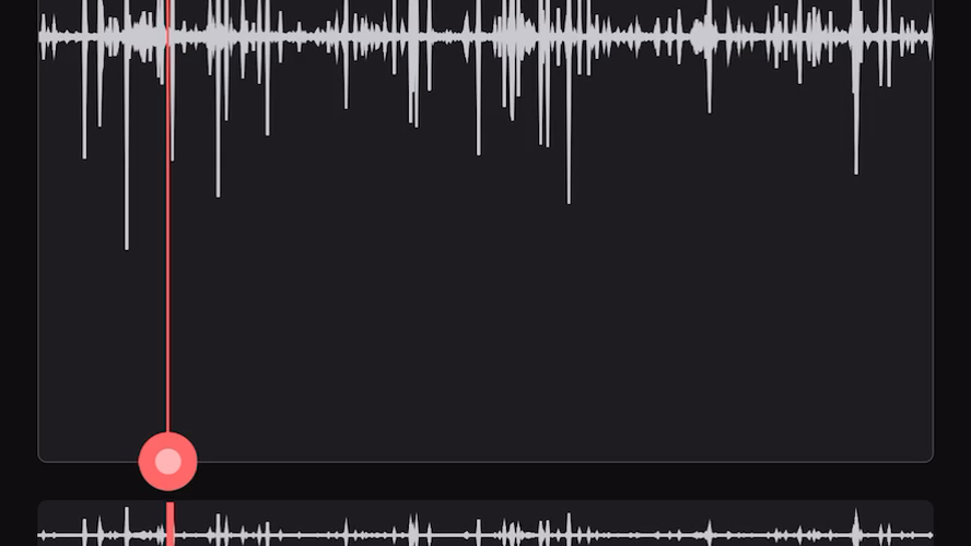 肠鸣音肚脐眼流水音伴有鼓音5分钟(小肠的声音)哔哩哔哩bilibili