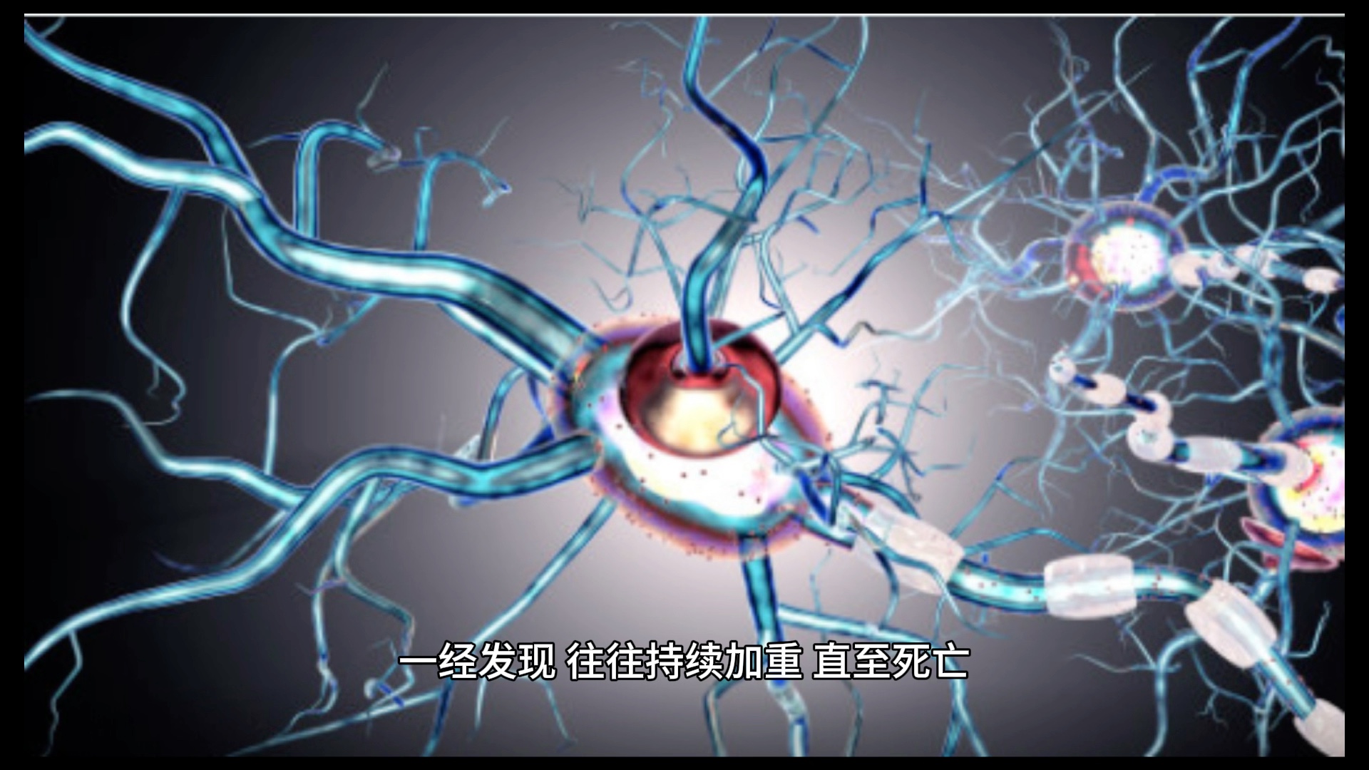 什么是运动神经元病?