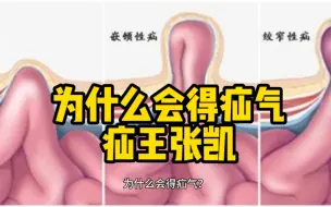 Télécharger la video: 为什么会得疝气？