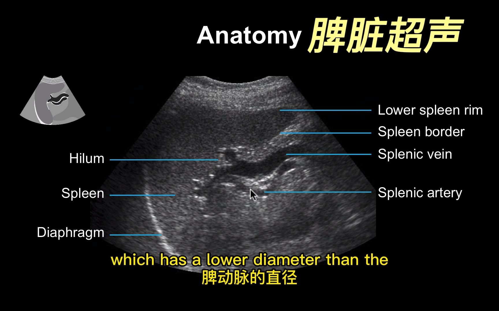 【腹部超声】脾脏超声哔哩哔哩bilibili