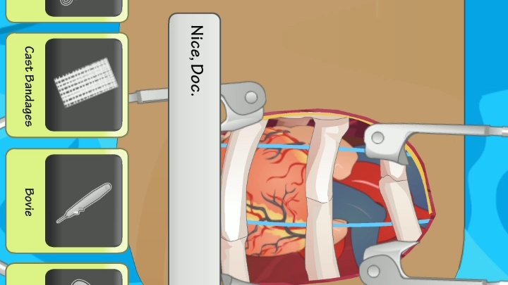 模拟手术(心脏)手机