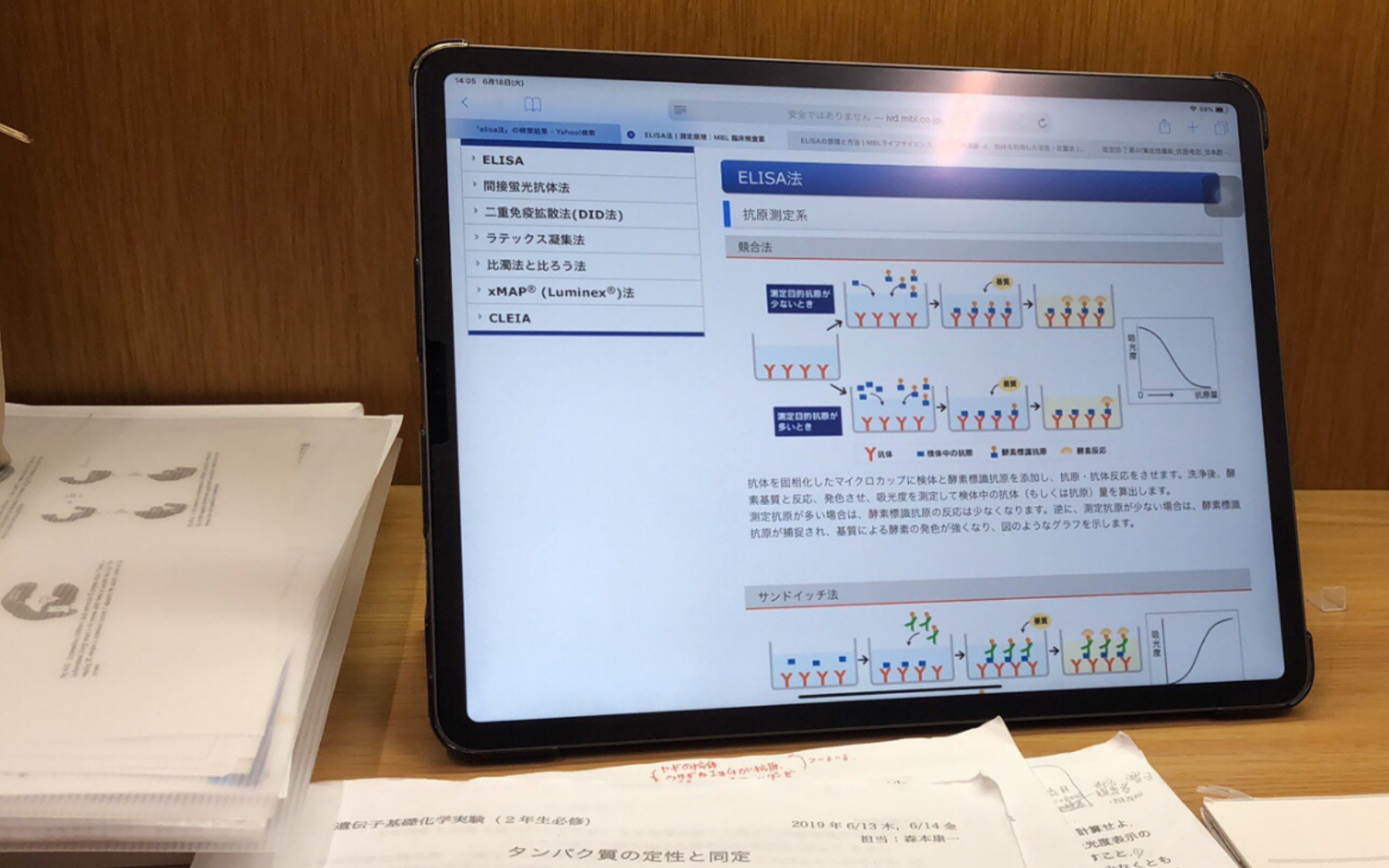 在日本读大学的丧狗....加速学习....ipad笔记....其他啥也看不到就只能看到我的脸嘻嘻哔哩哔哩bilibili