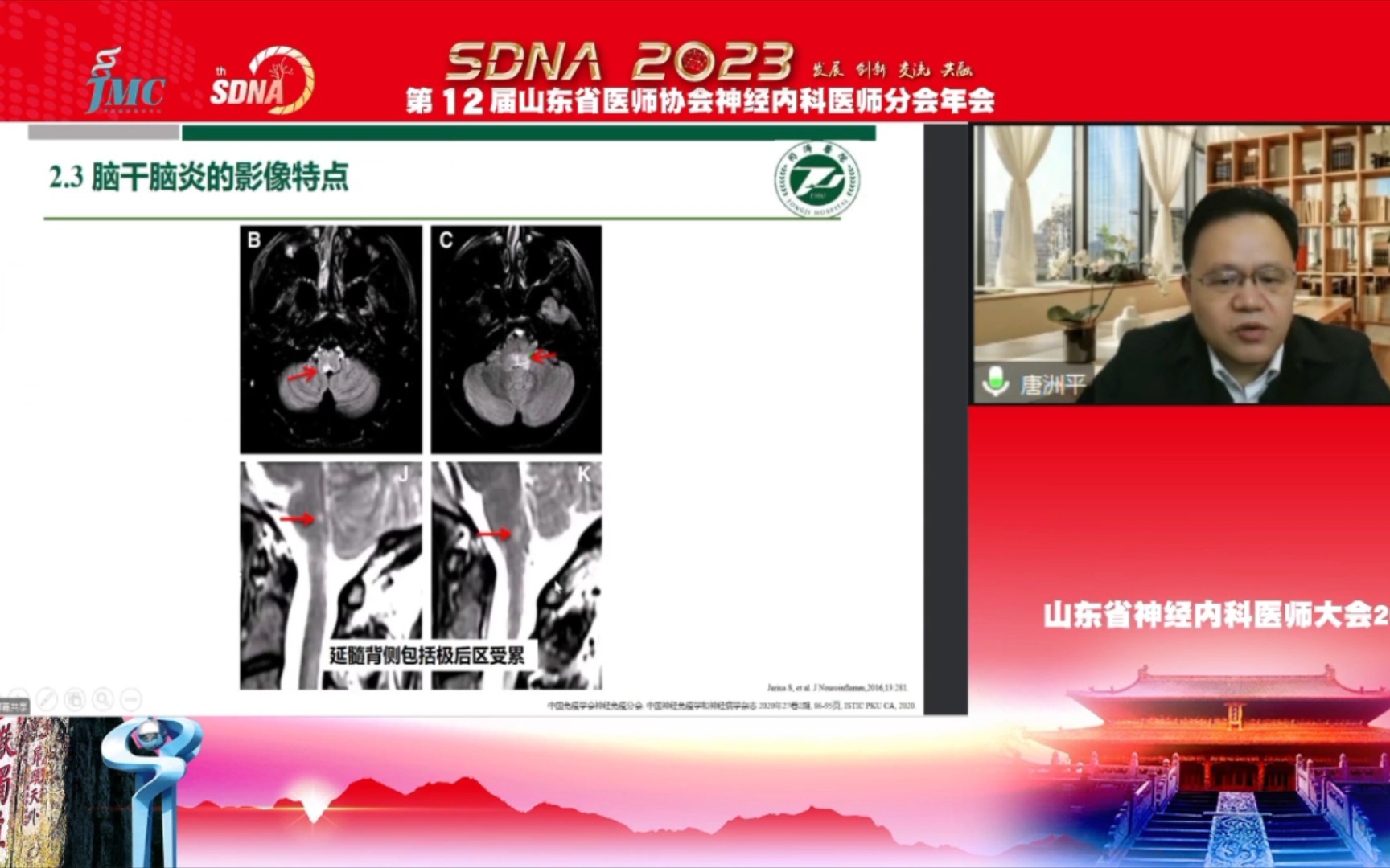 MOG相关疾病的临床表现、影像学特征以及治疗哔哩哔哩bilibili