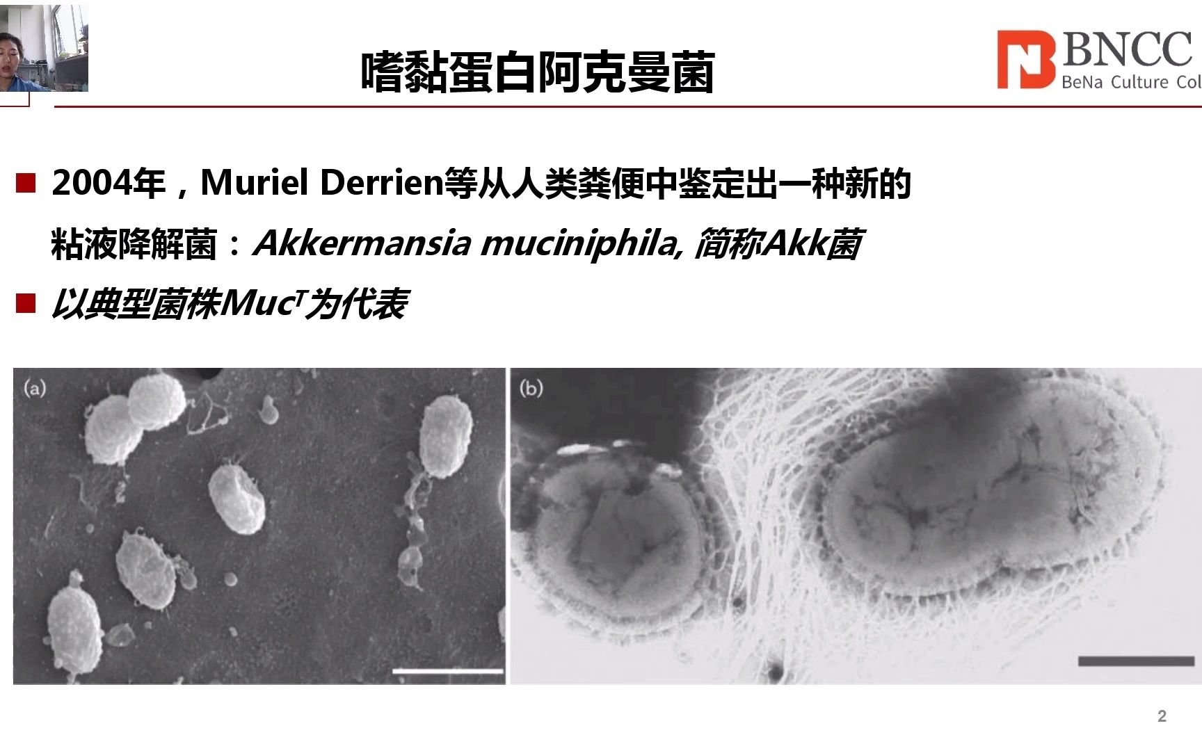 嗜黏蛋白阿克曼氏菌的研究进展和应用前景哔哩哔哩bilibili