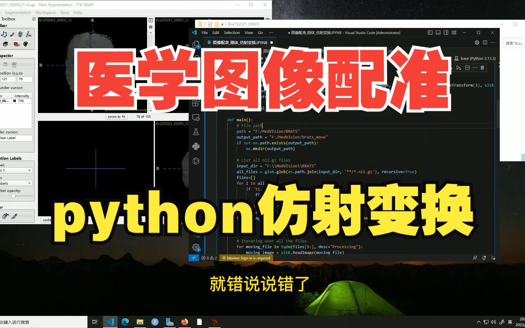 医学图像数据处理预处理医学图像配准python实战哔哩哔哩bilibili