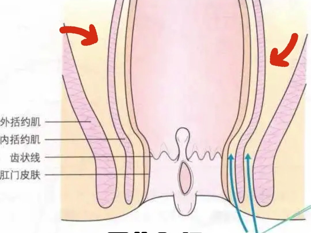 陈菊科普,肛门内括约肌的作用哔哩哔哩bilibili