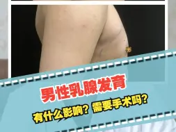 Télécharger la video: 男性乳腺发育，有什么影响？需要手术吗？