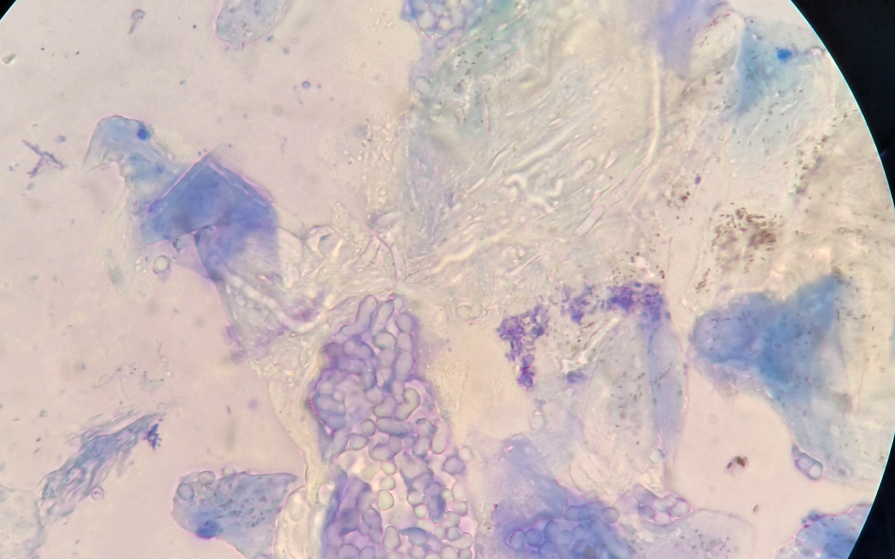 小分生孢子显微镜图片图片