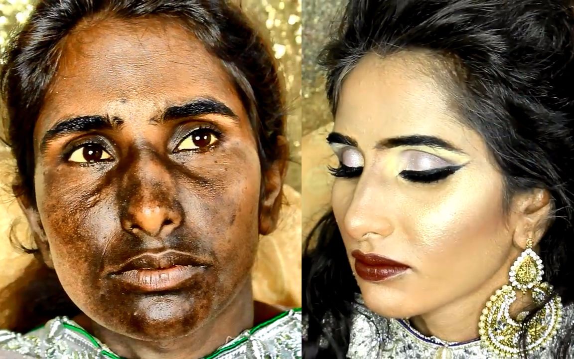 印度女子因化妆后的美貌重拾了被毁容后肤色乌黑的自信g26岁印度女子