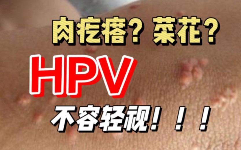 【医学喵】hpv病毒是什么,如何导致宫颈癌,菜花,喉癌,女性如何内检?