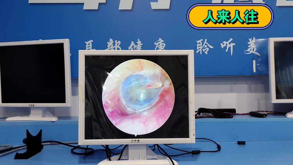 可视采耳采耳神器可视耳镜采耳仪器机器采耳采耳可视耳镜厂家采耳设备