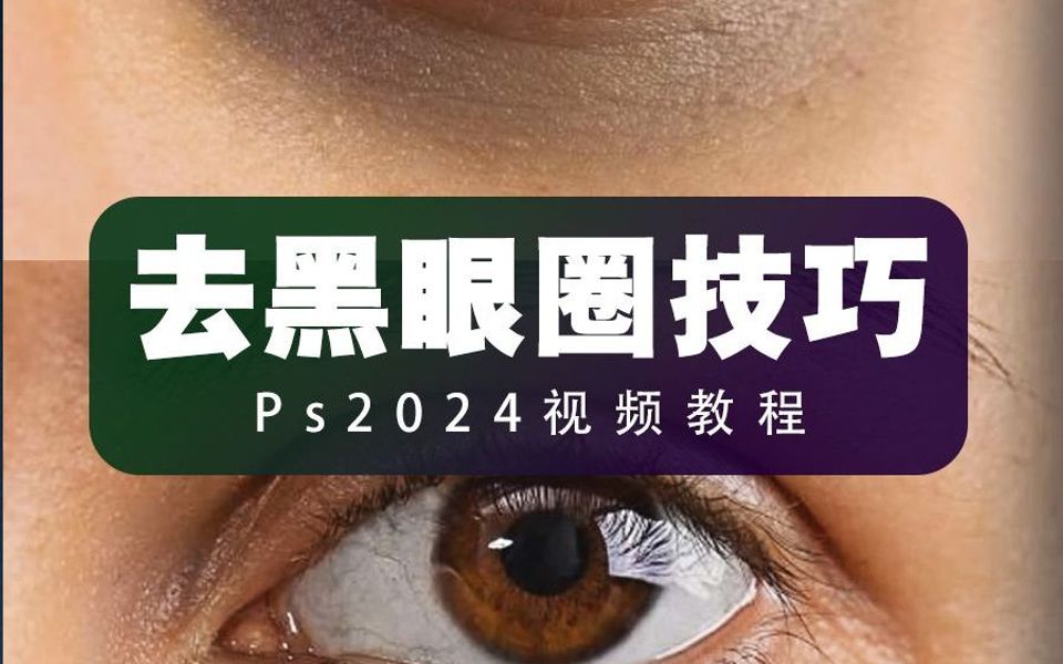 820去黑眼圈技巧