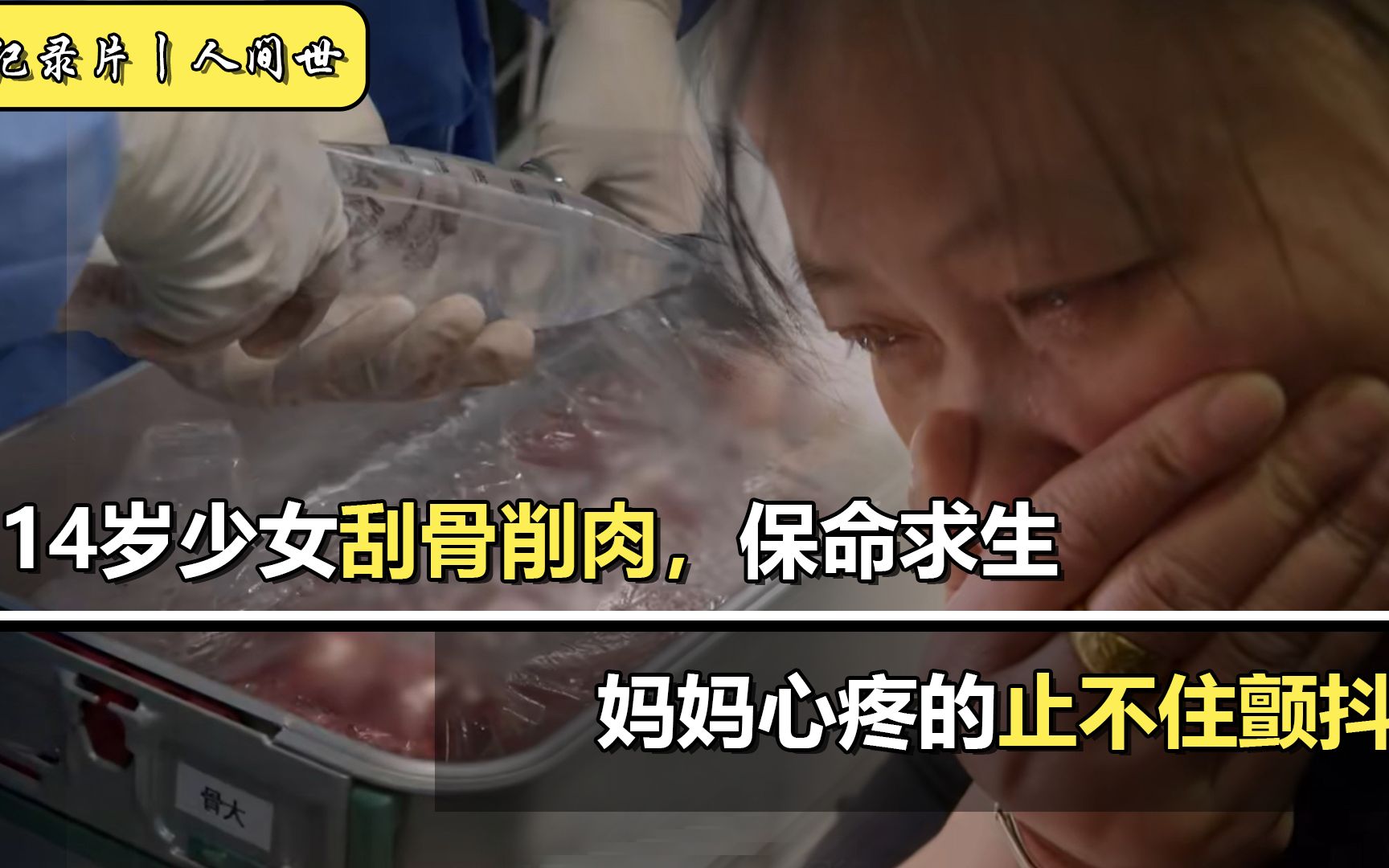 [图]14岁女孩总喊腿疼，本以为是生长痛，却没成想要承受刮骨削肉之苦