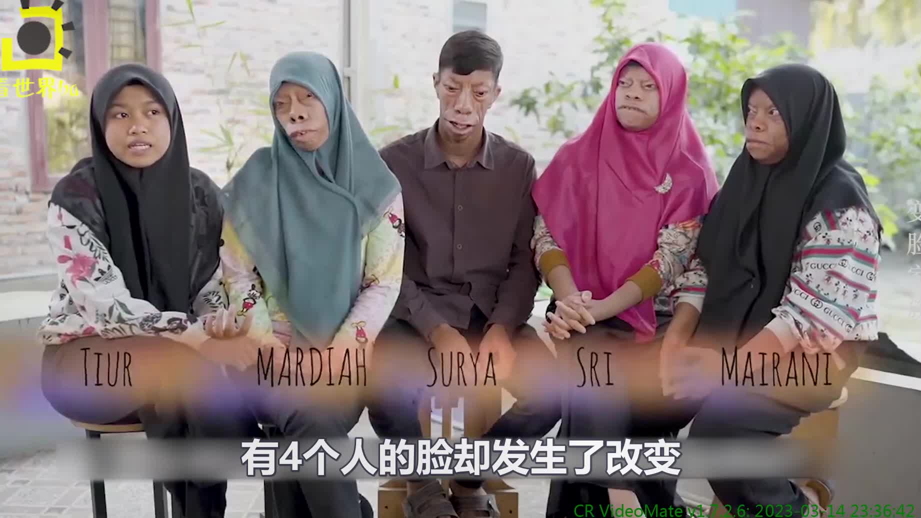 195. 纪录片:印尼家族遭遇罕见"怪病",兄妹6个,4个"变脸"