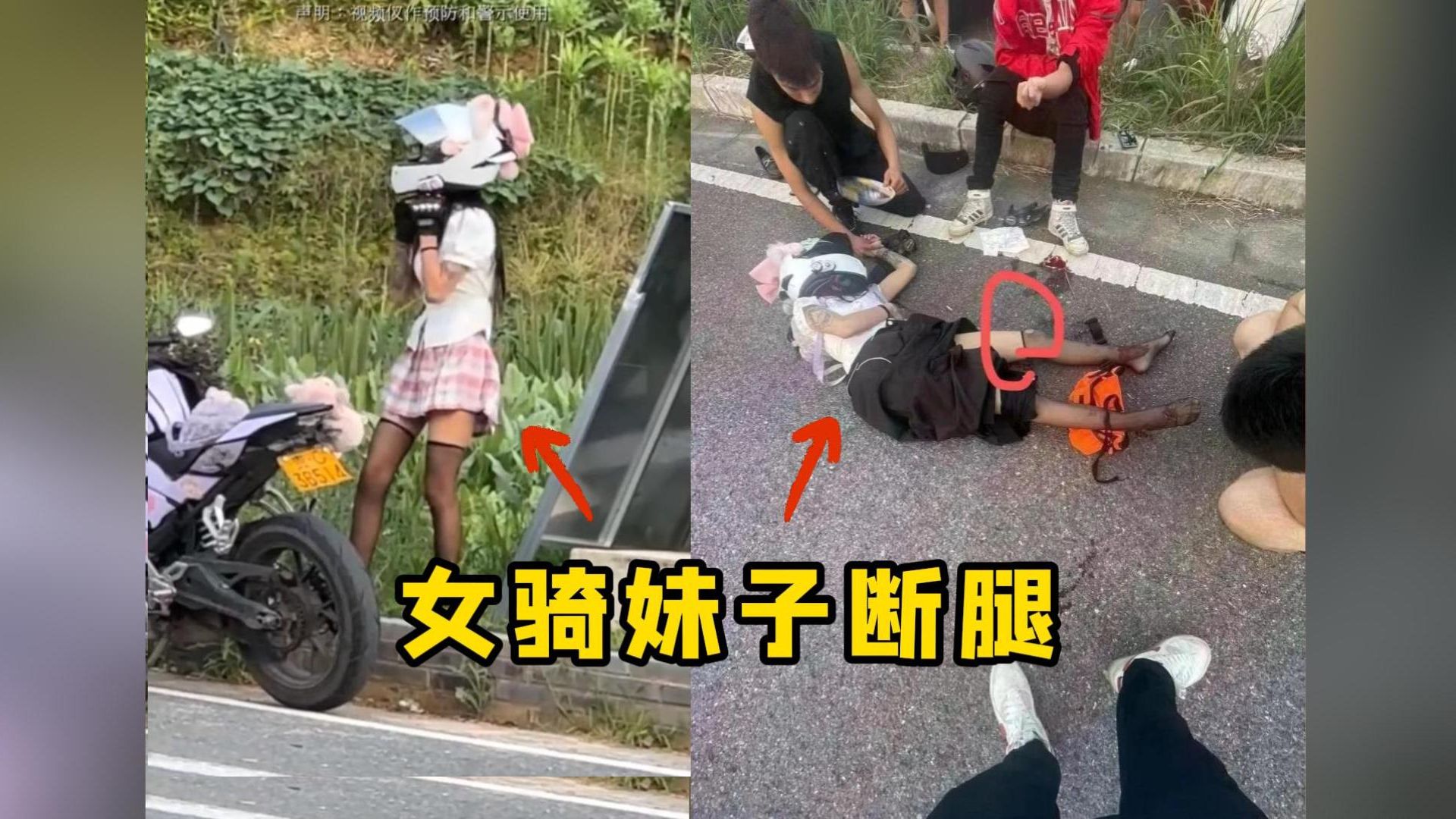 [图]挖槽！逆行超车，女骑妹子腿惨遭撞断，看着都痛