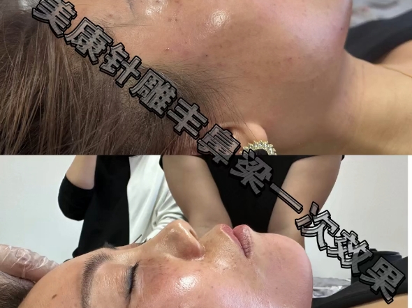 针灸美雕哪家好—美康针灸美雕