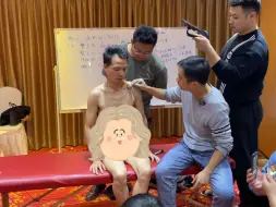 Descargar video: 臂丛神经的体表投影与易卡压点