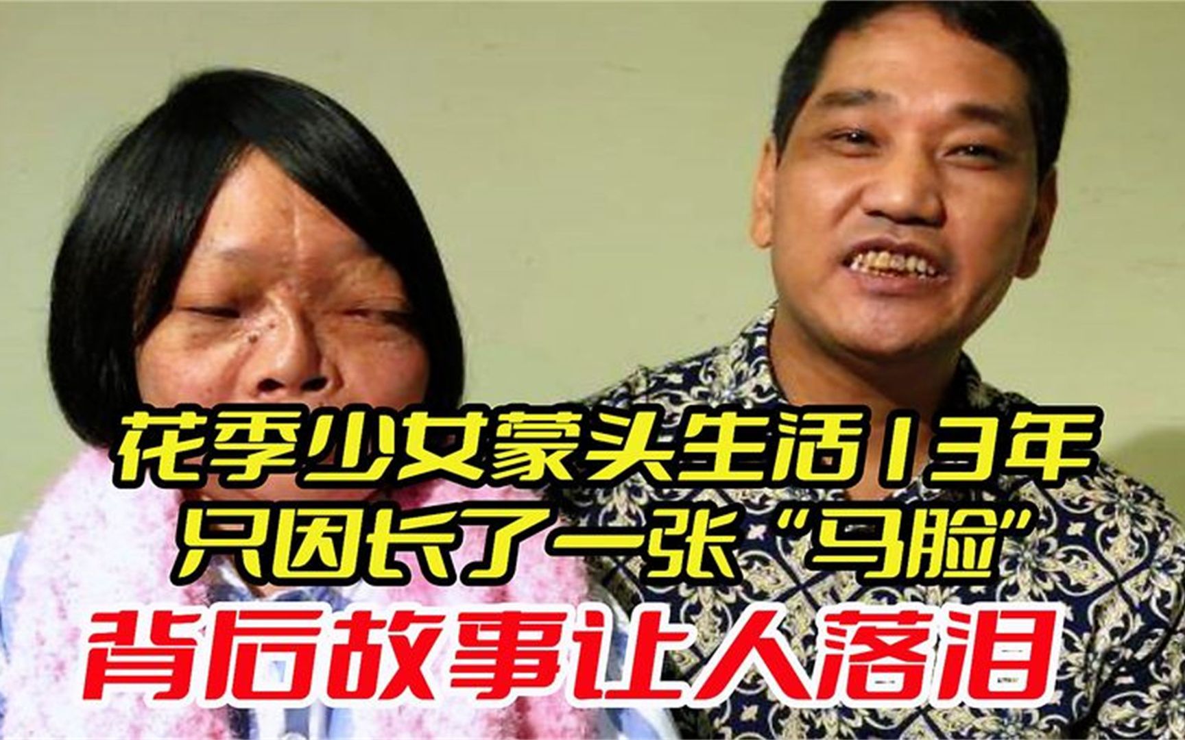 花季少女蒙头生活13年,只因长了一张"马脸",故事背后让人落泪