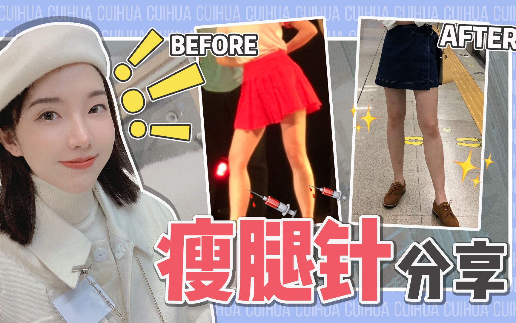 瘦腿针到底有多神奇?打完秒变女团腿?哔哩哔哩bilibili