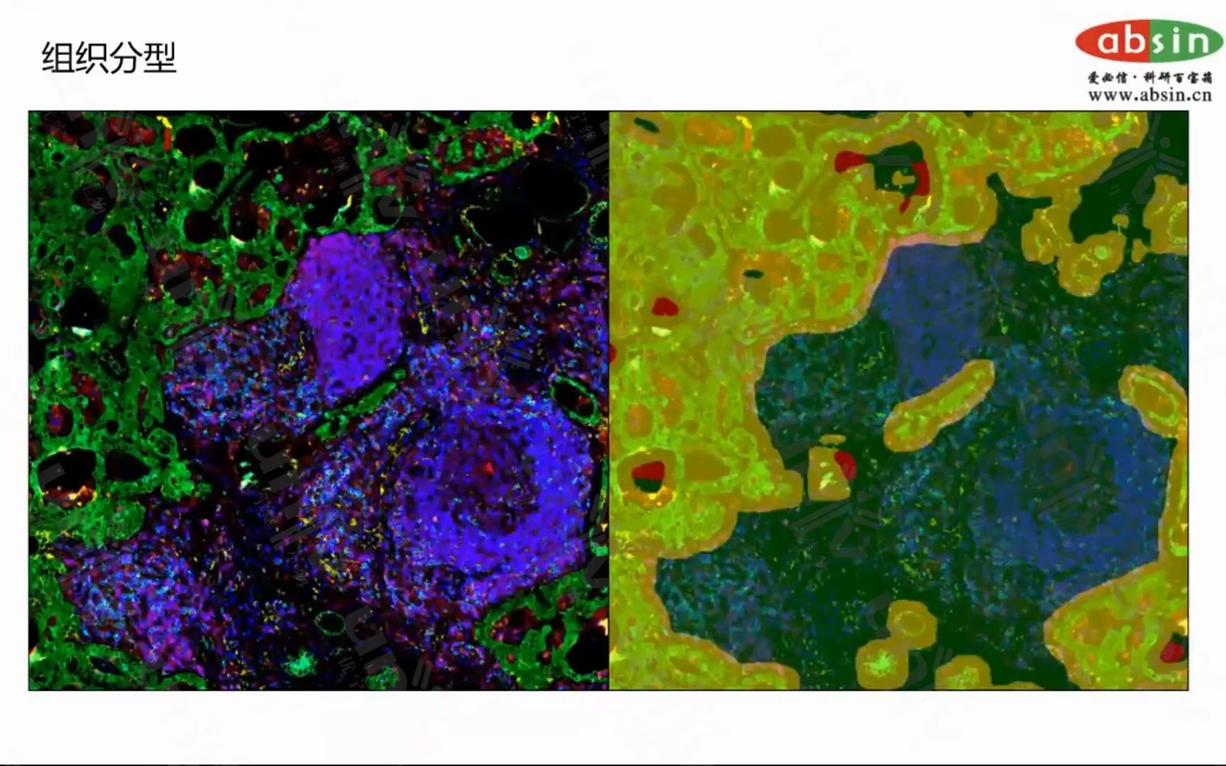 多重荧光免疫组化数据分析——组织分型哔哩哔哩bilibili