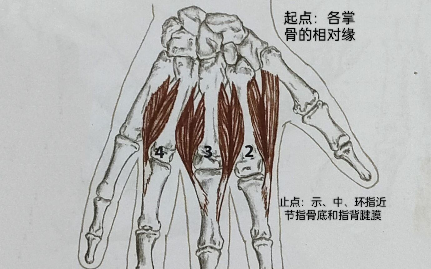 肌电图案例分析第1骨间背侧肌萎缩哔哩哔哩bilibili