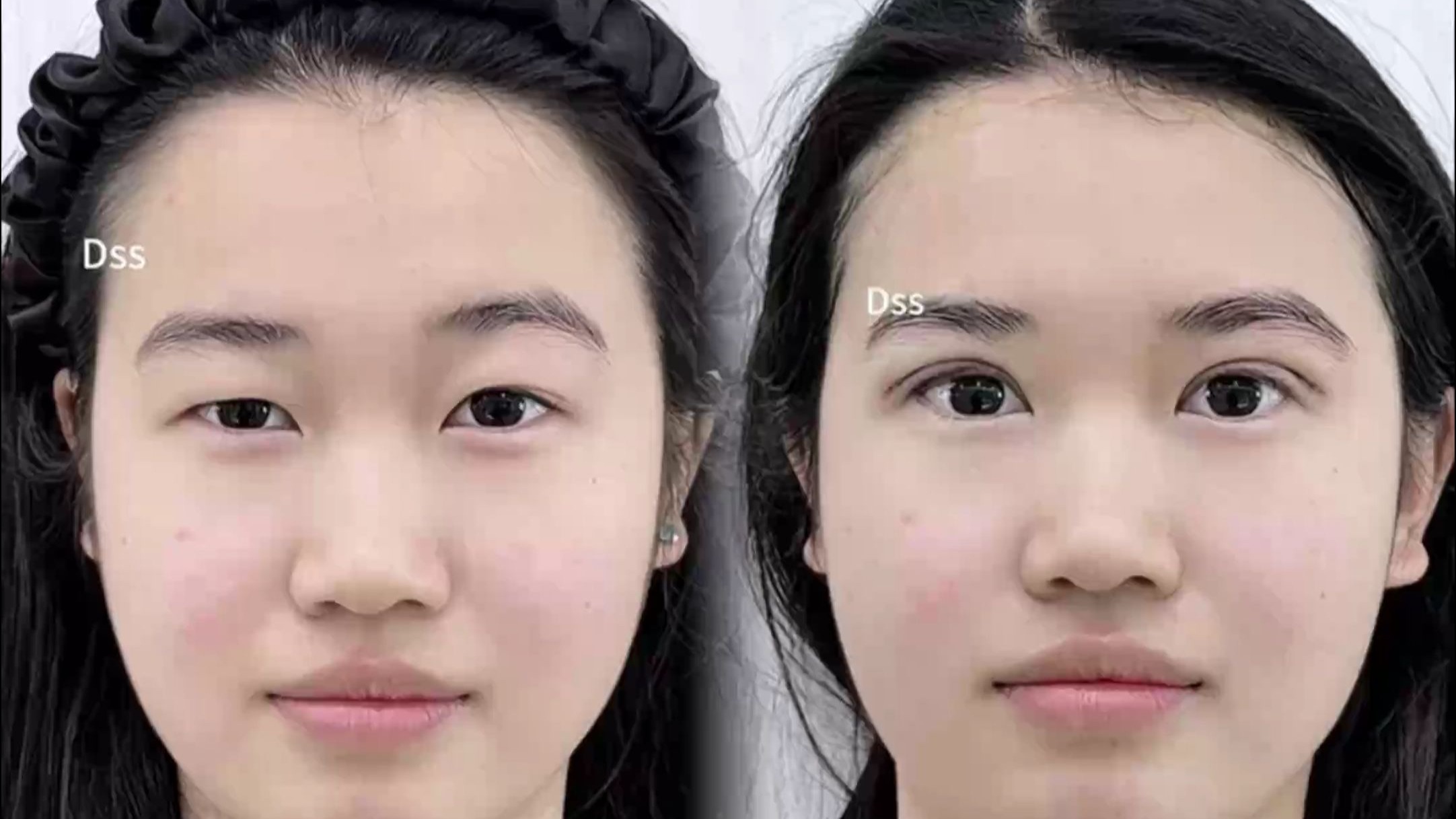 大小眼,再也不尴尬了!