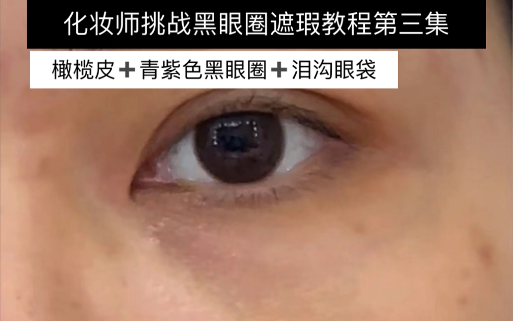 化妆师挑战黑眼圈遮瑕第三期青紫色黑眼圈加暗沉加泪沟 原相机手把手教程哔哩哔哩bilibili