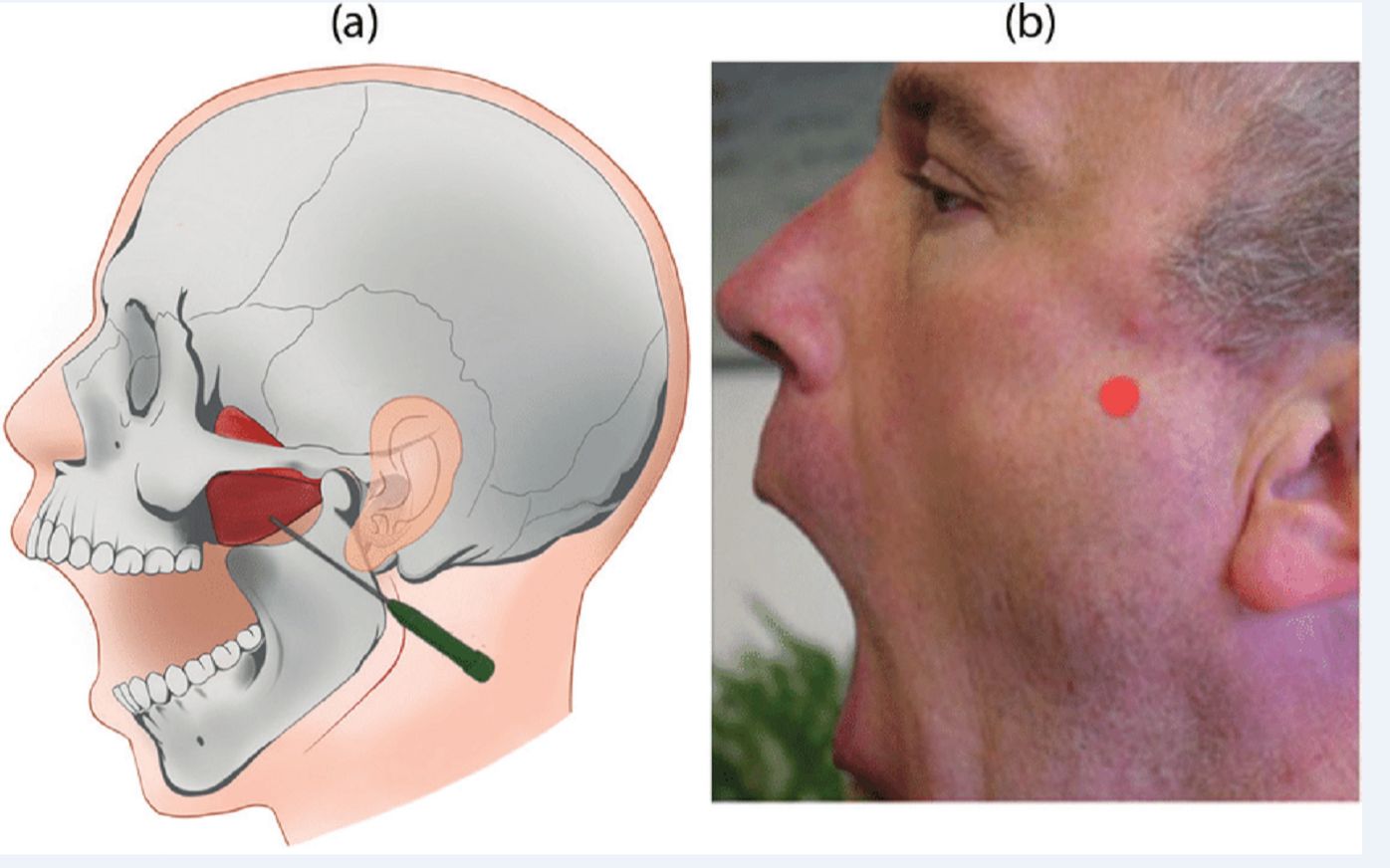 最自然高效【打开牙关/松牙关】的方法:借助重力_哔哩哔哩_bilibili