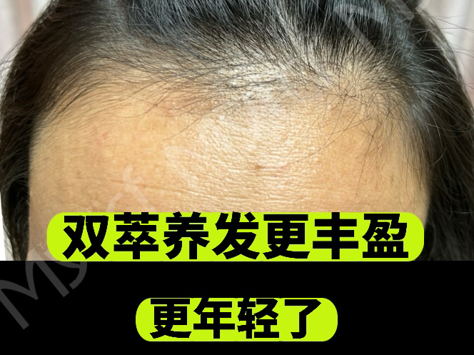 养发其实很复杂,吃的用的涂的……还要照顾生活习惯……养发其实很简单,十年技术积累~多途径入手,用起来又很简单~哔哩哔哩bilibili