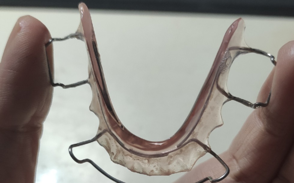 哈雷保持器到手,谈谈我对几种类型牙套的看法