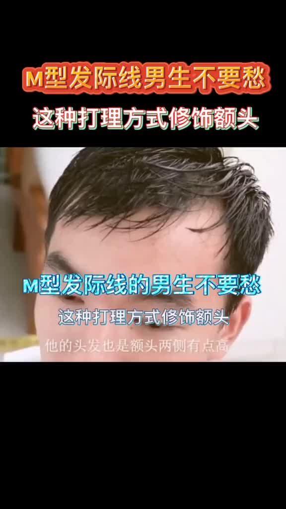 M型发际线不要愁#银川男士发型设计 #m字发际线 #锡纸烫哔哩哔哩bilibili