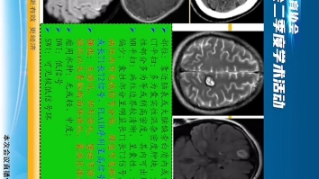 学习:侵删,广东省医学教育协会放射影像江神授课哔哩哔哩bilibili