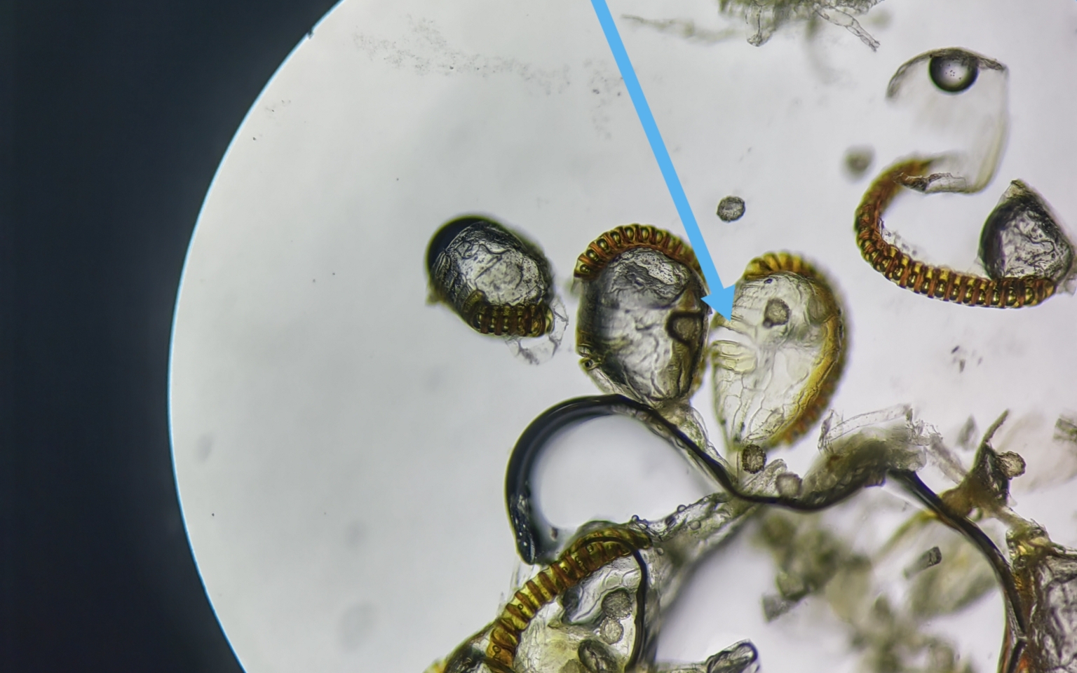 显微镜下观察——蜈蚣蕨孢子囊临时装片