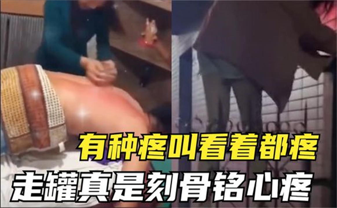 [图]盘点有种疼叫看着都疼，走罐痛彻心扉啊，妹子翻栏杆屁股被戳破了