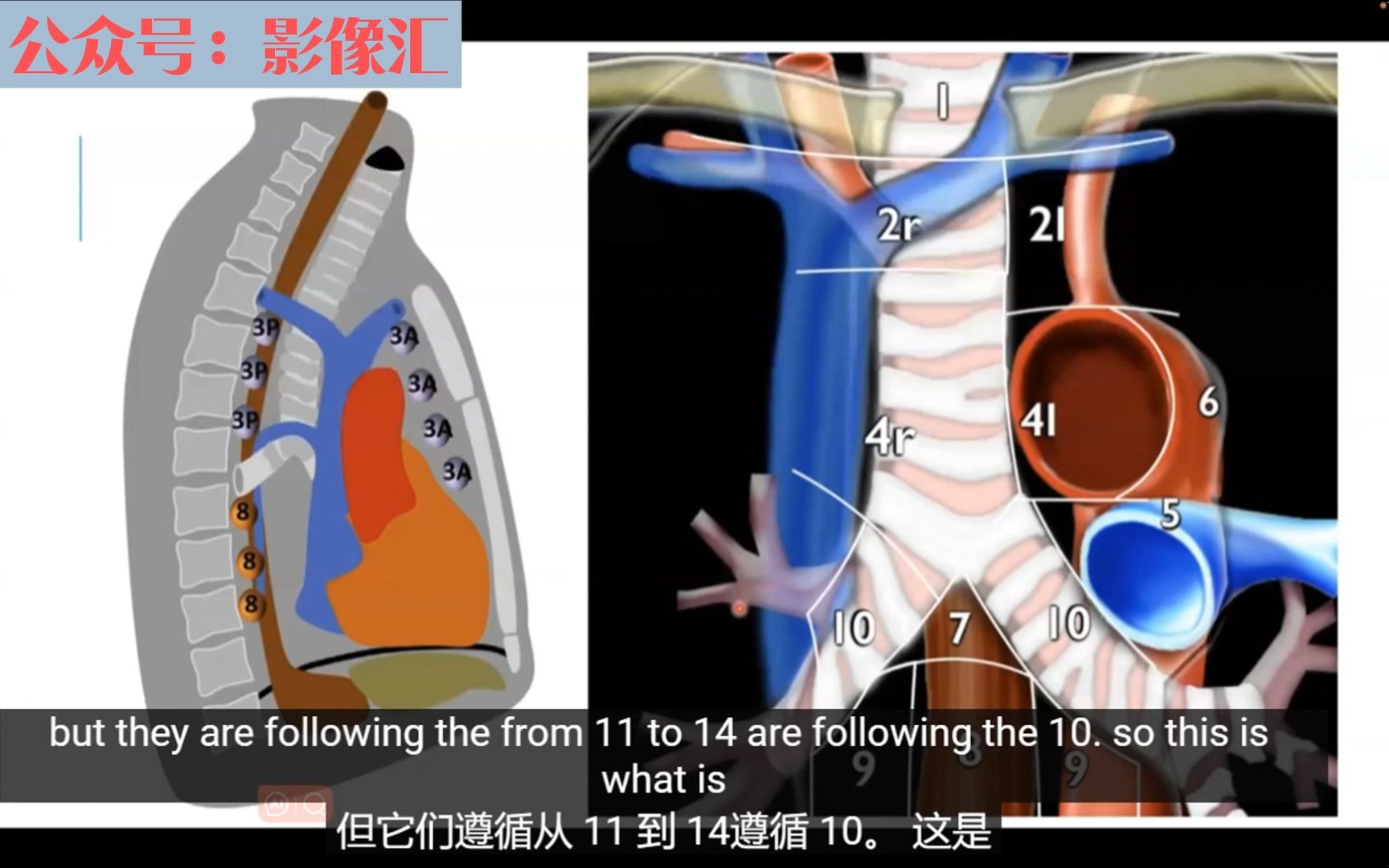 纵隔淋巴结分区解读,很详细请耐心听完哔哩哔哩bilibili