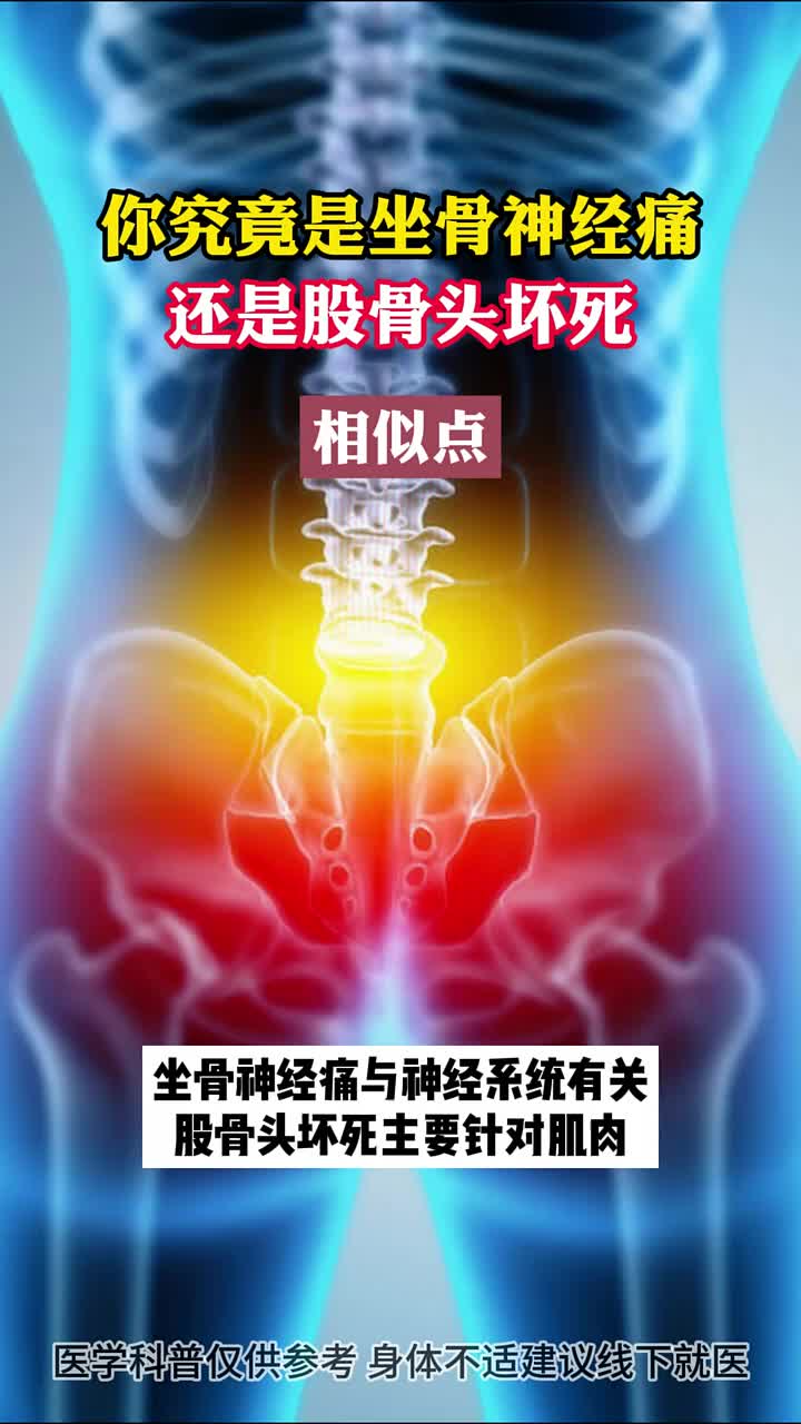 股骨头疼痛位置图片