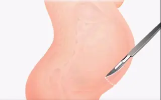 手术全过程 搜索结果 哔哩哔哩 Bilibili