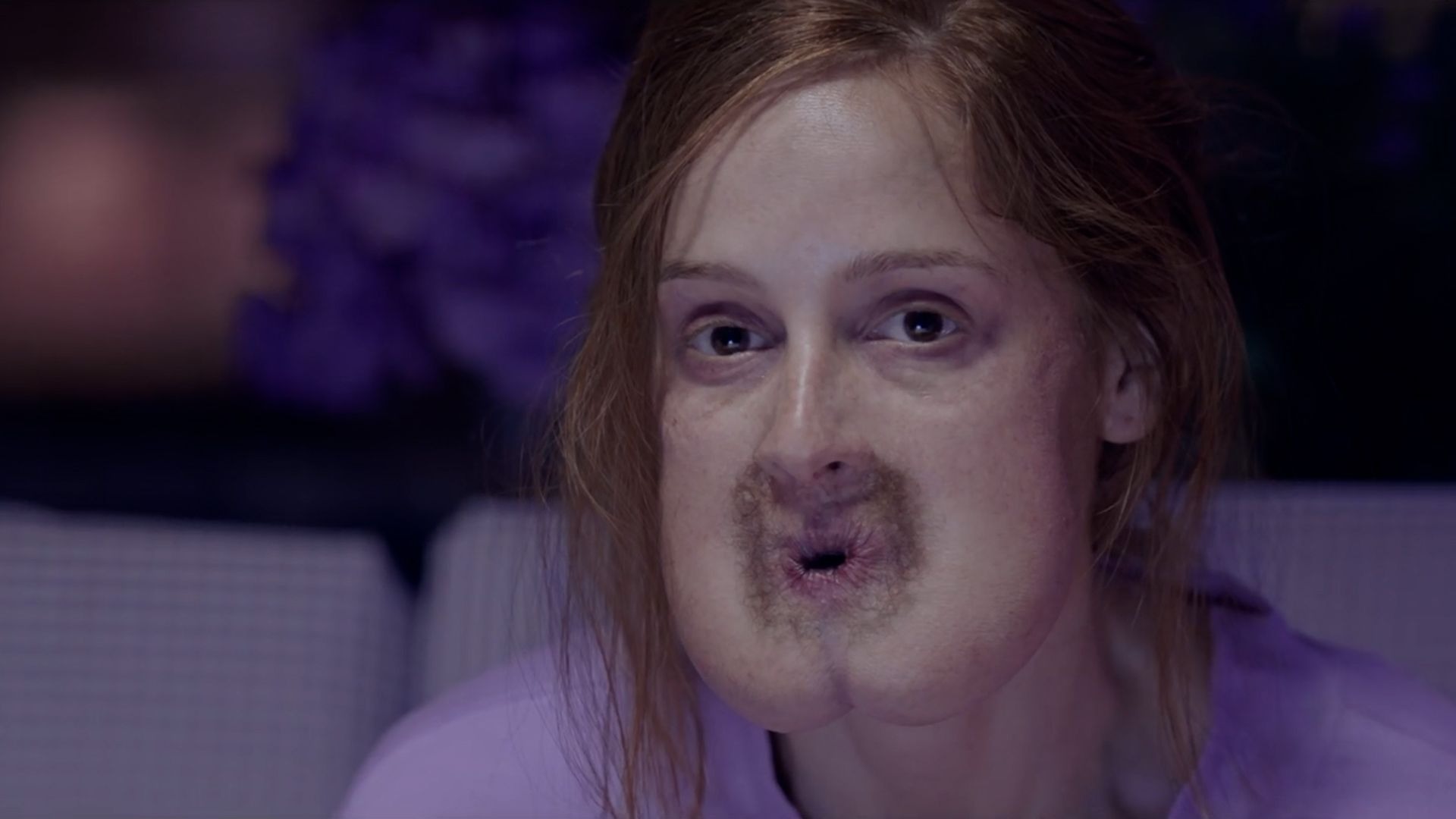 女孩的嘴巴与常人与众不同,每次到餐厅吃饭,她都会非常的尴尬!